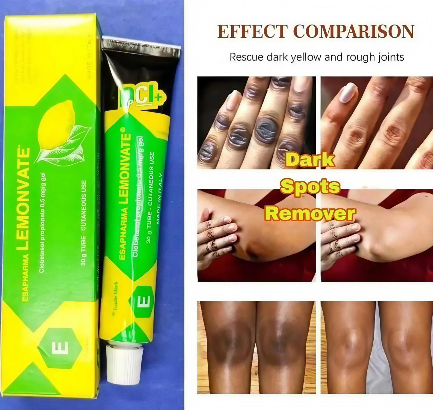 Esapharma Lemonvate Gel