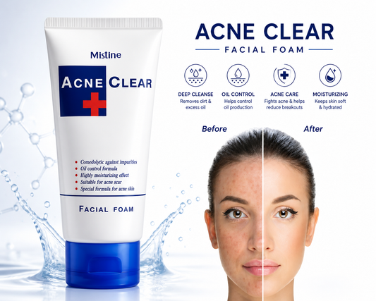 Mistine Acne Care Facial Foam (Thailand)